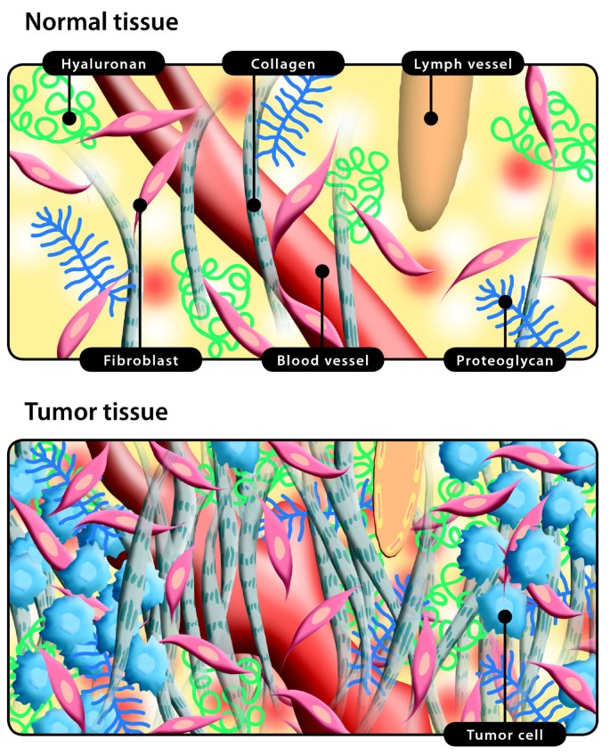 Interstitial fluid: the overlooked component of the tumor microenvironment?  | Fibrogenesis & Tissue Repair | Full Text