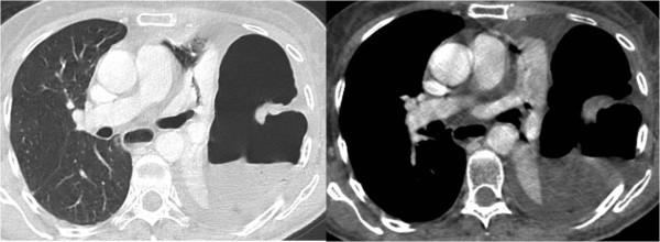 figure 2_90