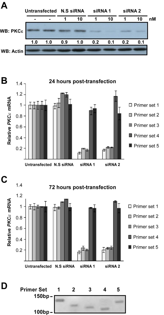 Detection of siRNA induced mRNA silencing by RT-qPCR: considerations for  experimental design | BMC Research Notes | Full Text