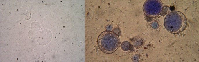 trichomonas hominis in stool