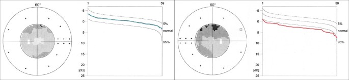 figure 22