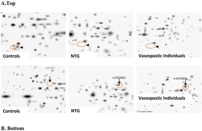 figure 22