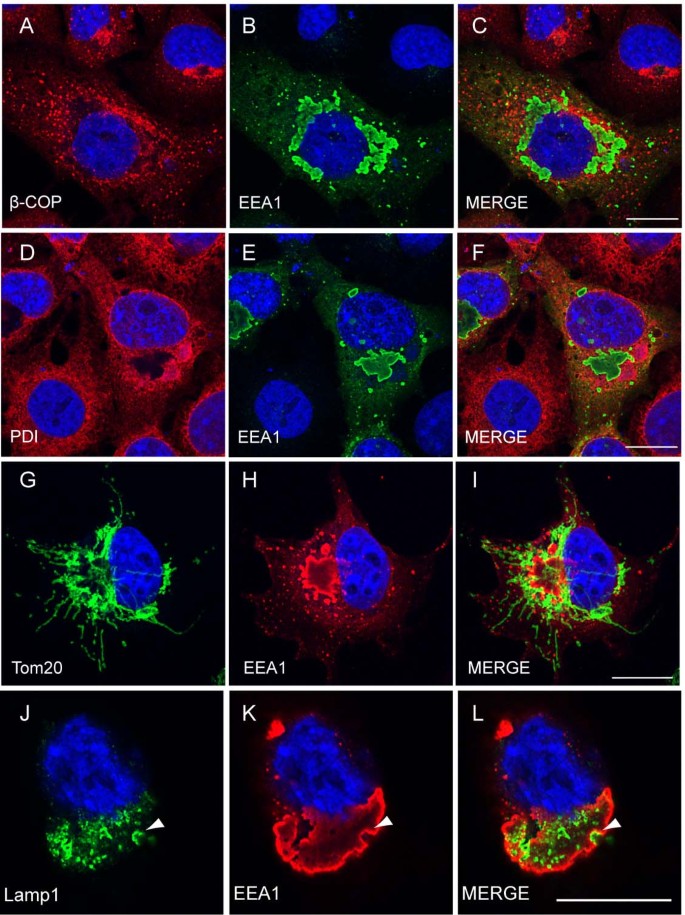 Monoubiquitination of EEA1 regulates endosome fusion and trafficking | Cell  & Bioscience | Full Text