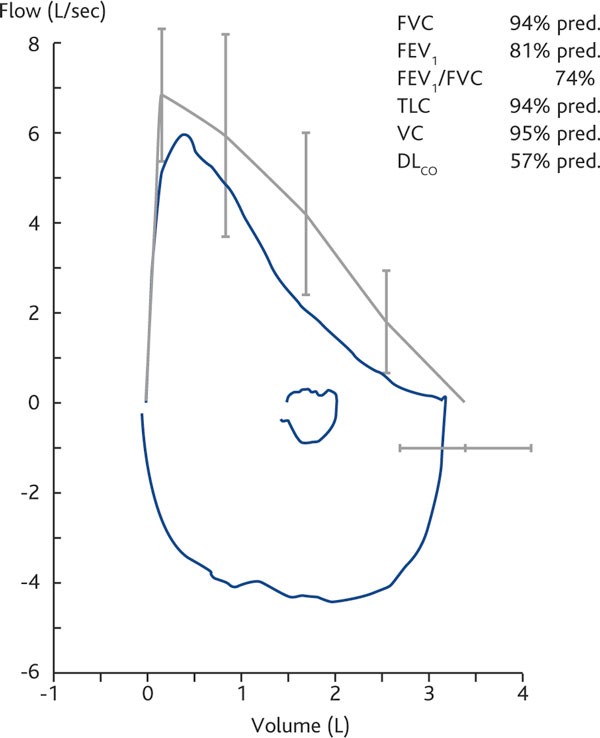 figure 1b