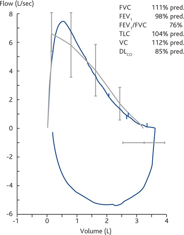 figure 2b