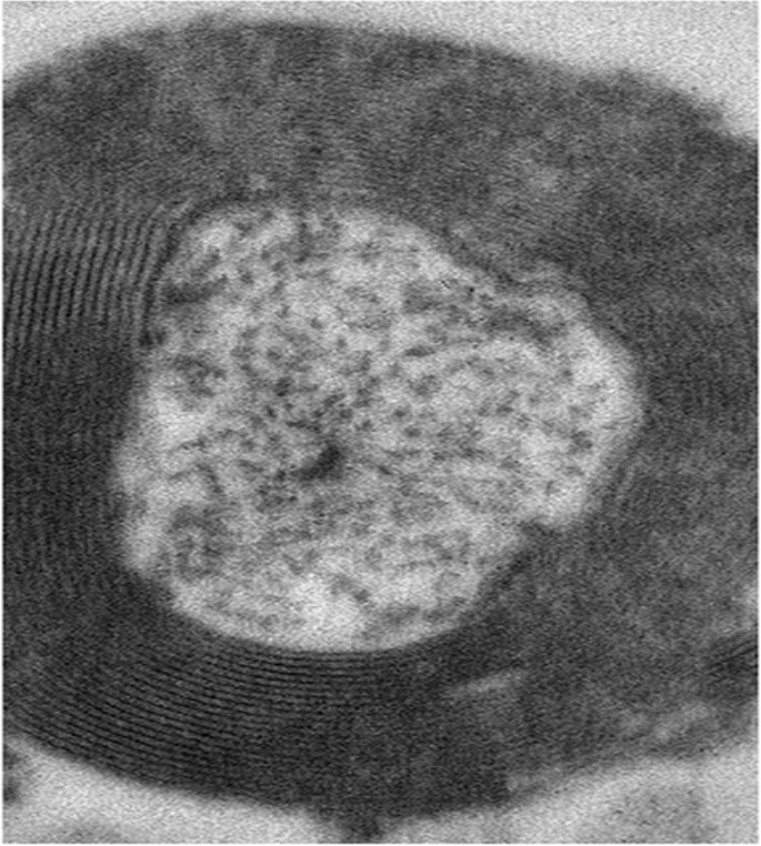 A high magnification image of synapse obtained by electron microscopy