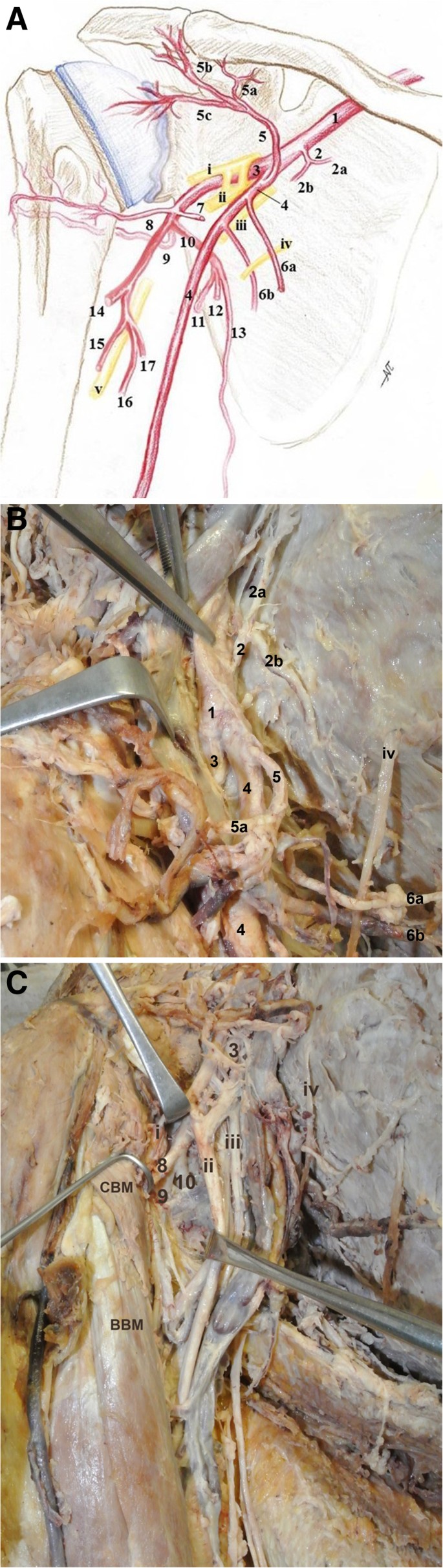 subscapular artery cadaver