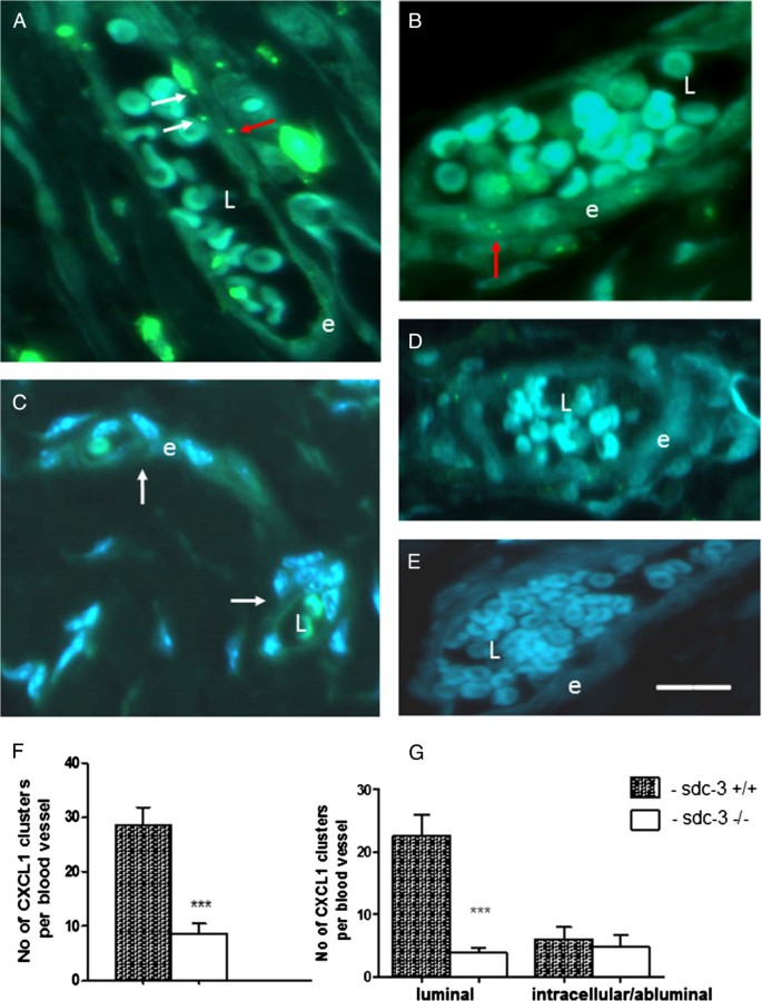 Syndecan-3 is selectively pro-inflammatory in the joint and contributes to  antigen-induced arthritis in mice, Arthritis Research & Therapy