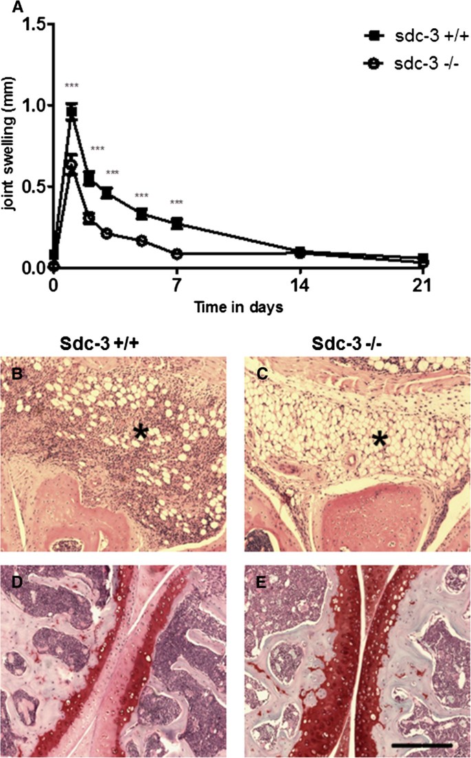 Syndecan-3 is selectively pro-inflammatory in the joint and contributes to  antigen-induced arthritis in mice, Arthritis Research & Therapy