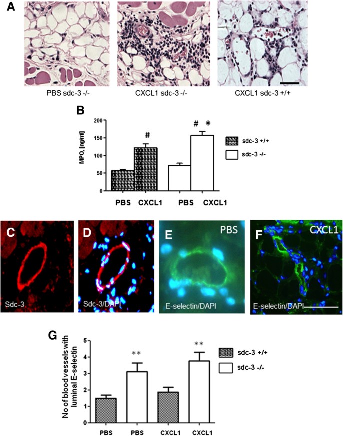 Syndecan-3 is selectively pro-inflammatory in the joint and contributes to  antigen-induced arthritis in mice, Arthritis Research & Therapy