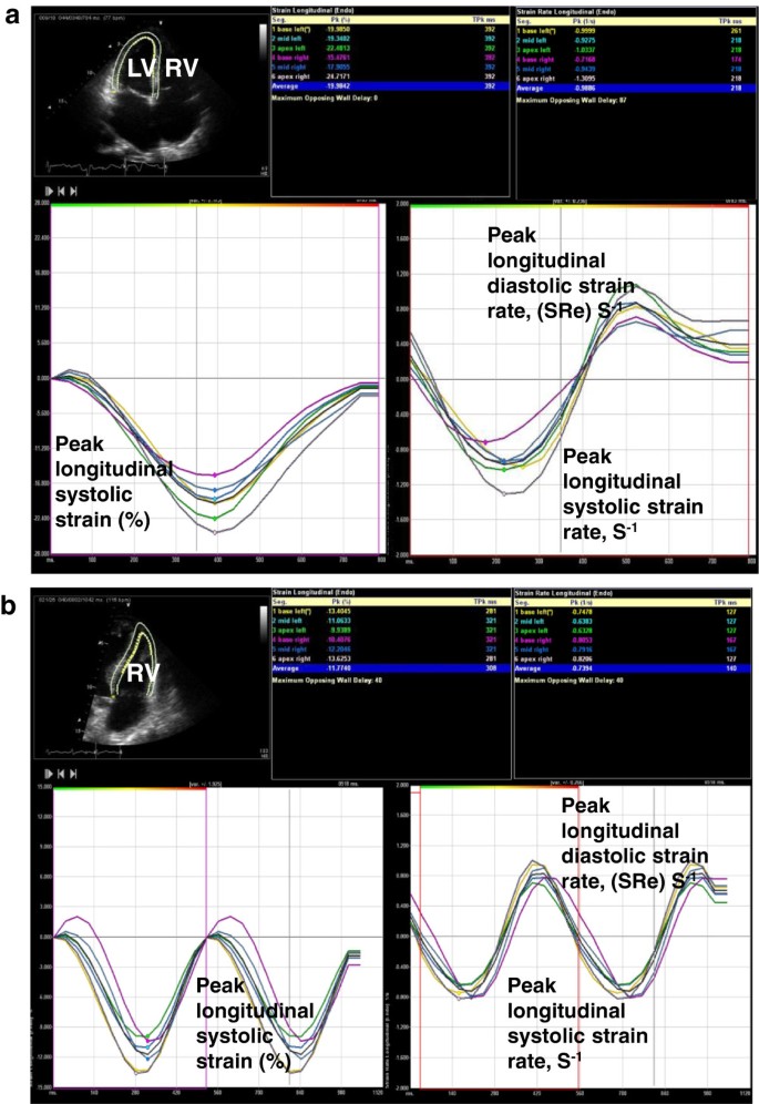 A method for direct estimation of left ventricular global longitudinal  strain rate from echocardiograms