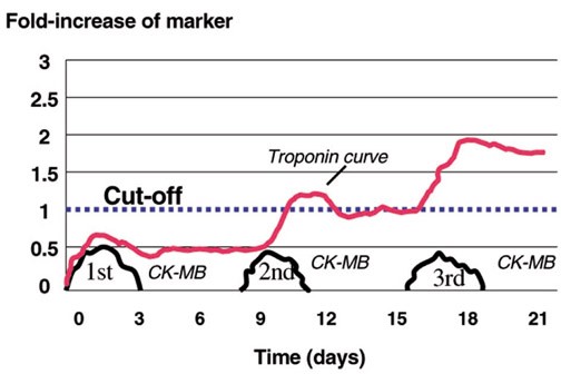 Implications of troponin testing in clinical medicine | Trials | Full Text