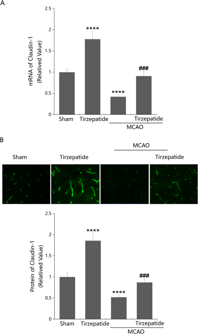 tirzepatide blood brain barrier Tirzepatide mitigates Stroke-Induced Blood-Brain barrier disruption by  modulating Claudin-1 and C/EBP-α pathways | Molecular Medicine