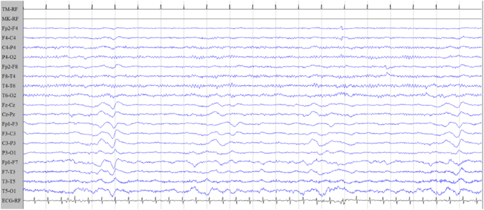 figure 37