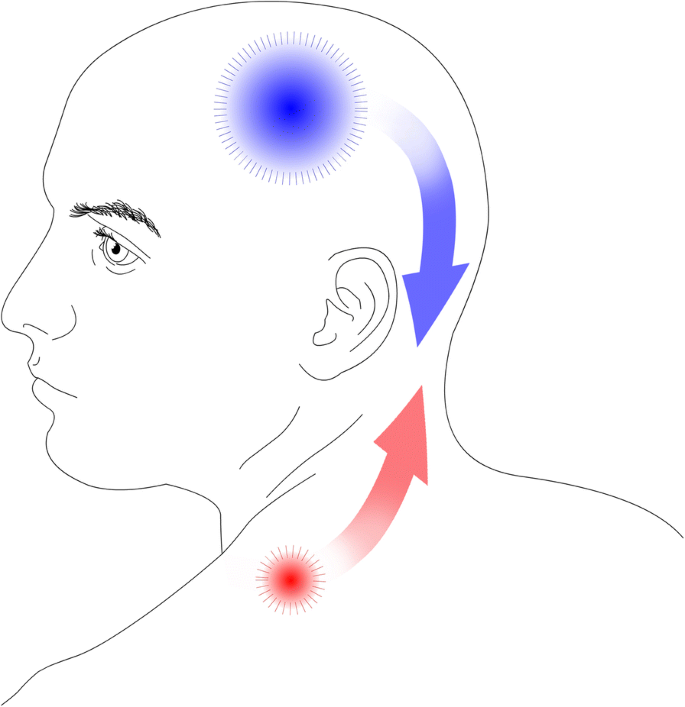 Myofascial Trigger Points In Migraine And Tension Type Headache The Journal Of Headache And Pain Full Text