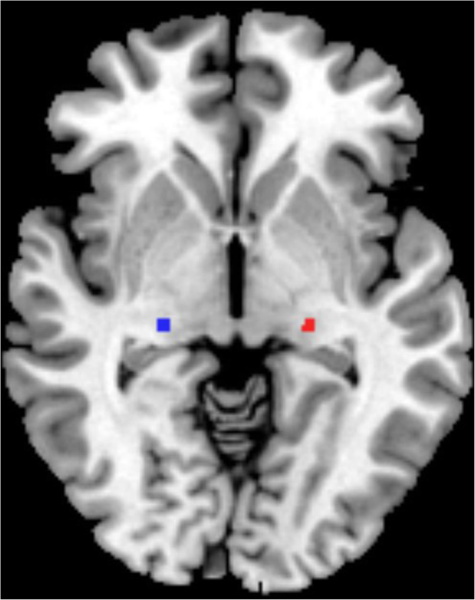 geniculate body