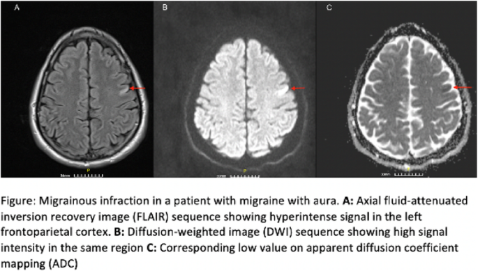 figure 148