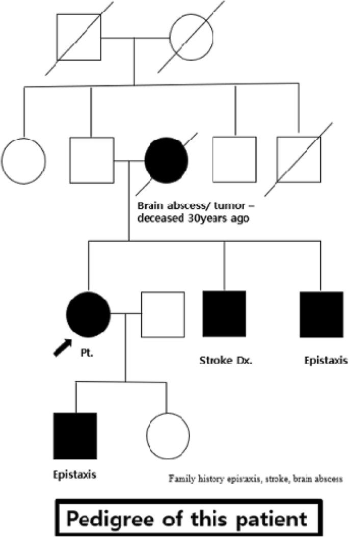 figure 34