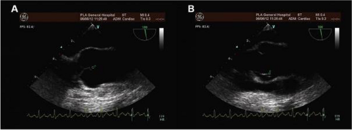 figure 146