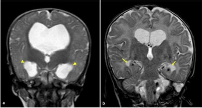 figure 180