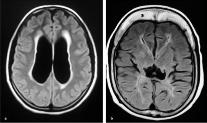 figure 181