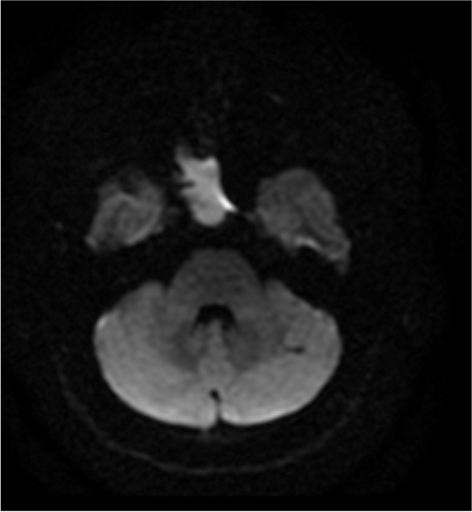 figure 50