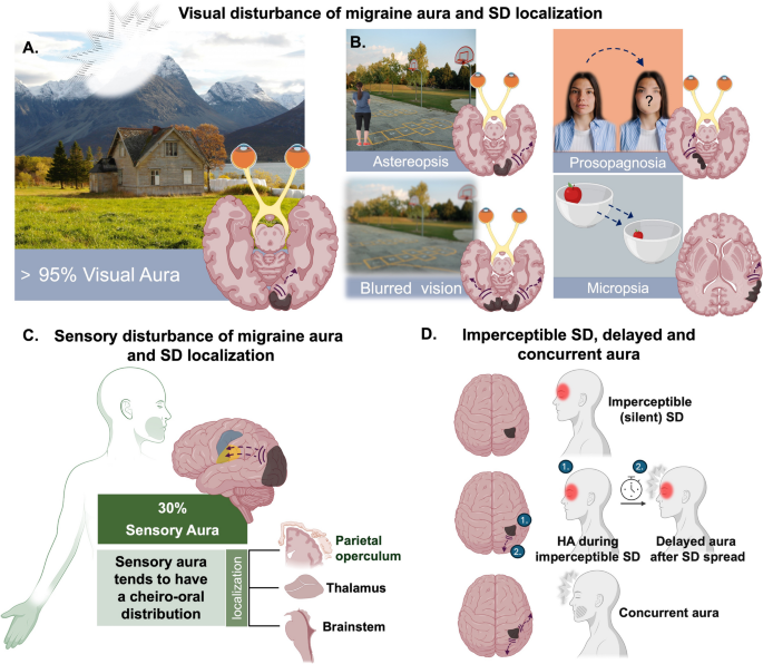 does glutathione help with headaches Is canonical SD a clinically relevant model of migraine? Argument pro | The  Journal of Headache and Pain