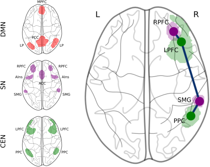 Triple Network Model And Rdoc Triple network disruption in medication overuse headache: functional ...