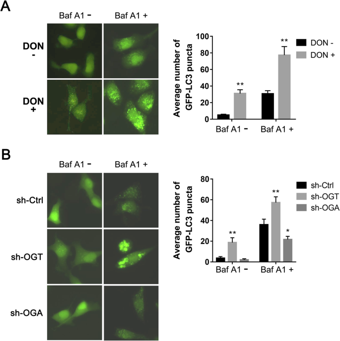 Pharmacological Inhibition of O-GlcNAcase Enhances Autophagy in