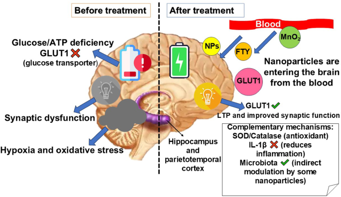 glutathione deficiency treatment Nanoparticles that target nonamyloid and nontau pathways in Alzheimer's disease | Discover Nano