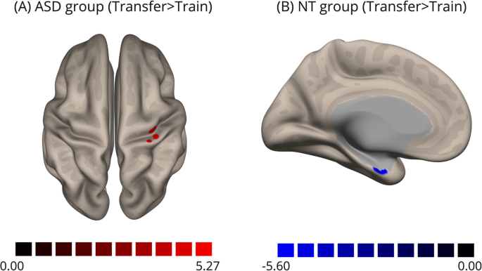 Neurofeedback training of executive function in autism spectrum
