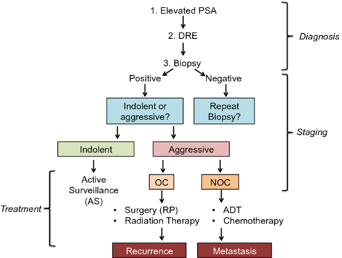 metastatic prostate cancer diagnosis and treatment Kezelési módszerek Prostatitis Vélemények