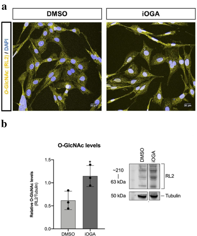 Pharmacological Inhibition of O-GlcNAcase Enhances Autophagy in