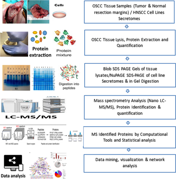 Secreted protein markers in oral squamous cell carcinoma (OSCC) | Clinical  Proteomics | Full Text