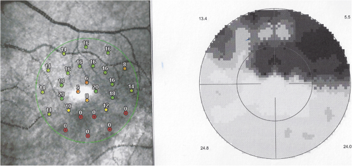 figure 15