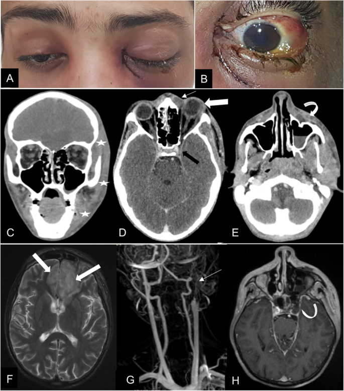 figure1