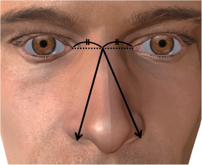 Nose size indicates maximum penile length | Basic and Clinical Andrology |  Full Text