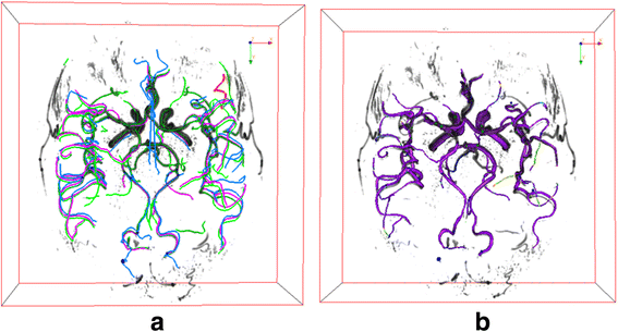 figure 14