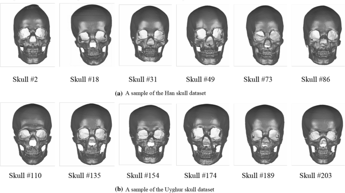 Aninet A Deep Neural Network For Skull Ancestry Estimation Bmc Bioinformatics Full Text