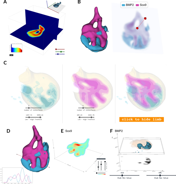 791364 Limblab: pipeline for 3D analysis and visualisation of limb bud gene ...