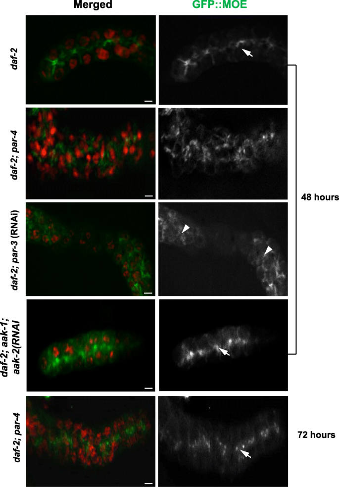 Genome-wide surveys reveal polarity and cytoskeletal regulators 