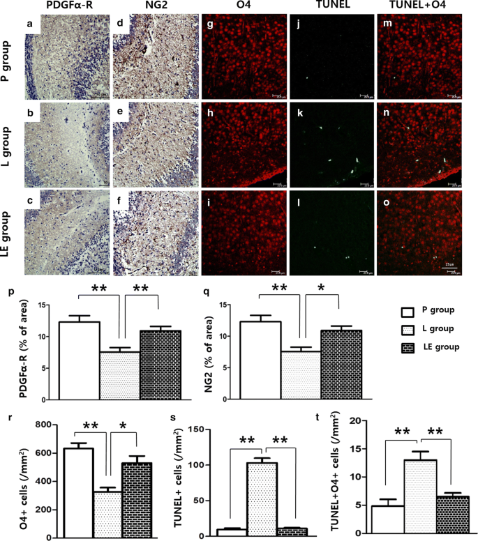 Tnf A Antagonist Attenuates Systemic Lipopolysaccharide Induced Brain White Matter Injury In Neonatal Rats Bmc Neuroscience Full Text