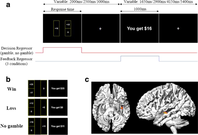 29th Annual Neuroscience Meeting: CNS*2020,BMC Neuroscience X-MOL