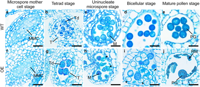 Fla14 Is Required For Pollen Development And Preventing Premature Pollen Germination Under High Humidity In Arabidopsis Bmc Plant Biology Full Text Fla14 Is Required For Pollen Development And Preventing Premature Pollen Germination Under High Humidity In Arabidopsis Bmc Plant Biology Full Text