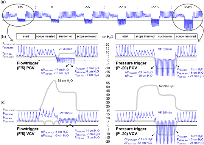 Can Ventilator Settings Reduce The Negative Effects Of Endotracheal Suctioning Investigations In A Mechanical Lung Model Bmc Anesthesiology Full Text