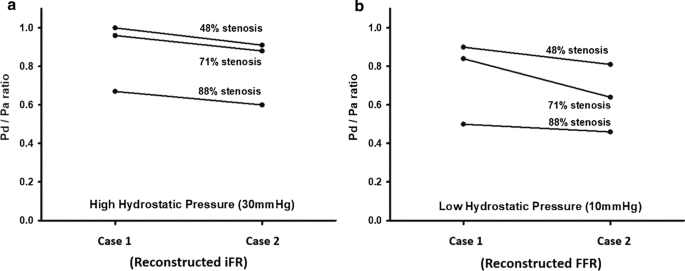 The Reasons Why Fractional Flow Reserve And Instantaneous Wave Free Ratio Are Similar Using Wave Separation Analysis Bmc Cardiovascular Disorders Full Text The Reasons Why Fractional Flow Reserve And Instantaneous Wave Free Ratio Are Similar Using Wave Separation Analysis Bmc Cardiovascular Disorders Full Text