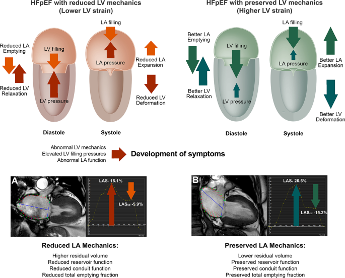 Left Ventricular Dysfunction — TPA