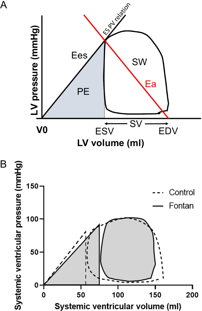 Left Ventricular Pressure-Volume Work Loop With Mechanical Circulatory  Support