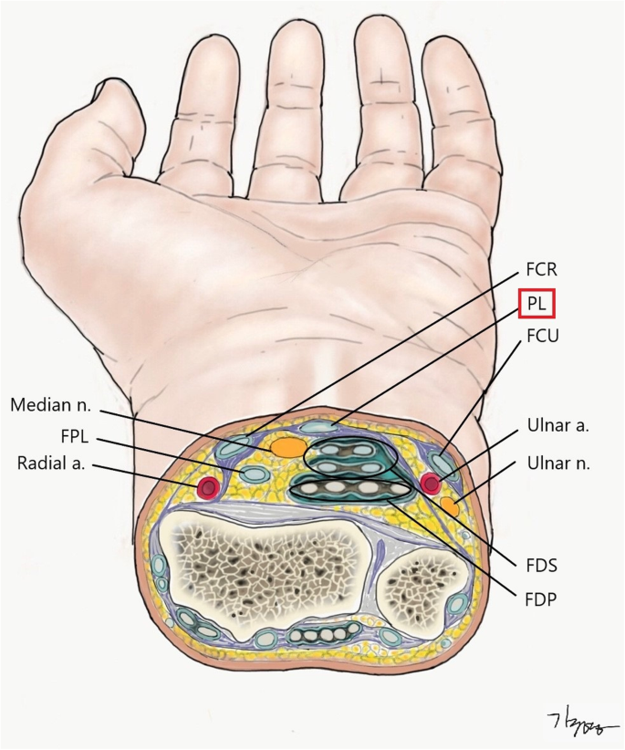 A pilot study of 17 wrist-cutting suicide injuries in single institution:  perspectives from a hand surgeon | BMC Emergency Medicine | Full Text