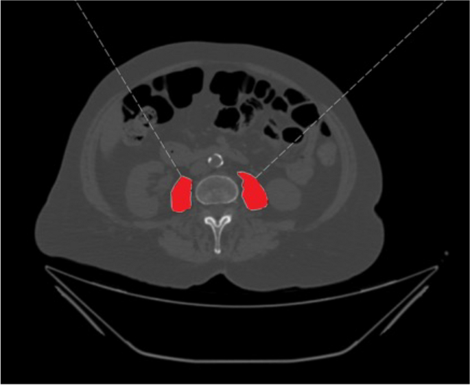 aging research reviews figure 1